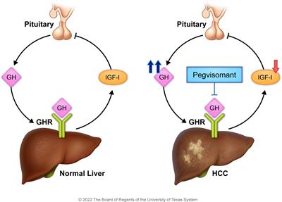 Blockade of growth hormone receptor signaling by using pegvisomant: A functional therapeutic strategy in hepatocellular carcinoma